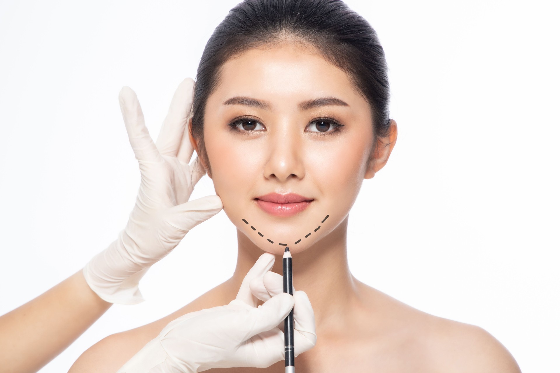 Linhas na face, fim acima, conceito da cirurgia plástica, mão do doutor na luva que faz marcas na face do paciente. Beleza asiática mulher no salão de beleza. clínica de cirurgia plástica.